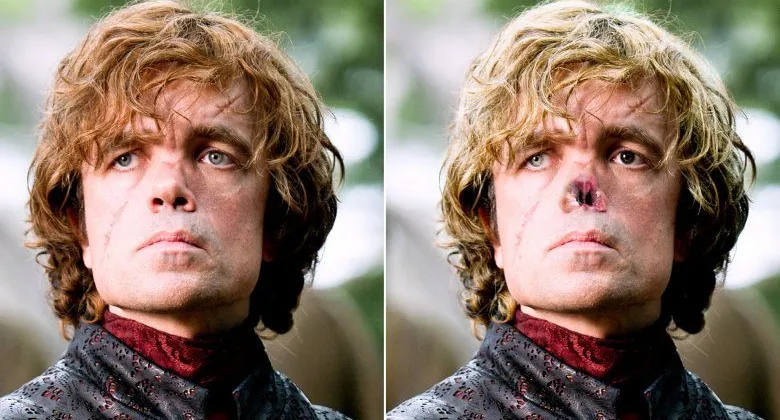 sau trận đ&aacute;nh Blackwater ở season 2, Sh&acirc;n vật Tyrion trong truyện đ&atilde; chịu một vết ch&eacute;m khủng khiếp v&agrave; mất đi ph&acirc;n nửa chiếc mũi của m&igrave;nh. 