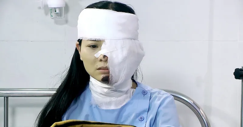 Kim C&uacute;c bị hại một c&aacute;ch đau đớn 