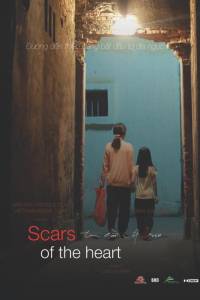 Tim Hằn Vết Sẹo